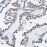 Immunohistochemistry - Anti-RGS14 Antibody (A12433) - Antibodies.com