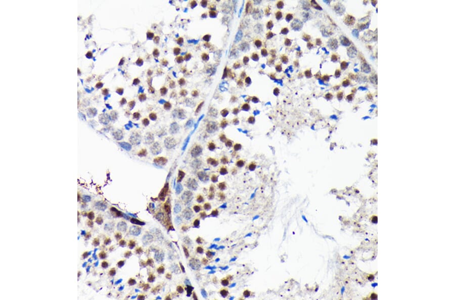 Immunohistochemistry - Anti-RGS14 Antibody (A12433) - Antibodies.com