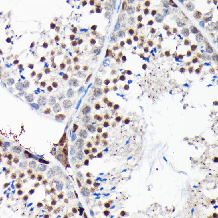 Immunohistochemistry - Anti-RGS14 Antibody (A12433) - Antibodies.com