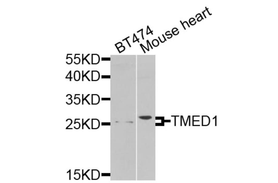 Western Blot - Anti-TMED1 Antibody (A9963) - Antibodies.com