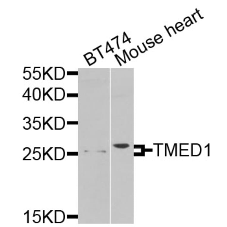 Western Blot - Anti-TMED1 Antibody (A9963) - Antibodies.com