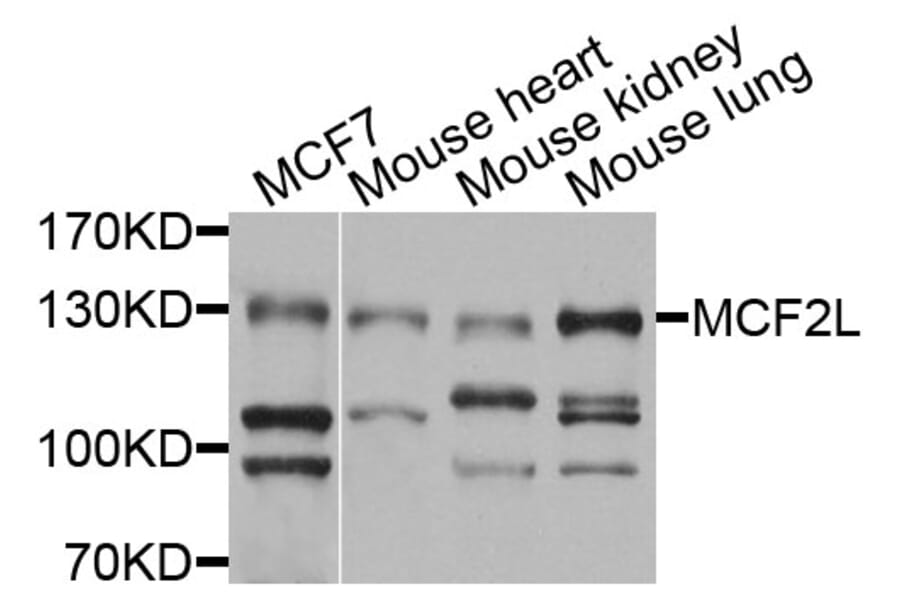 Western Blot - Anti-MCF2L Antibody (A9966) - Antibodies.com