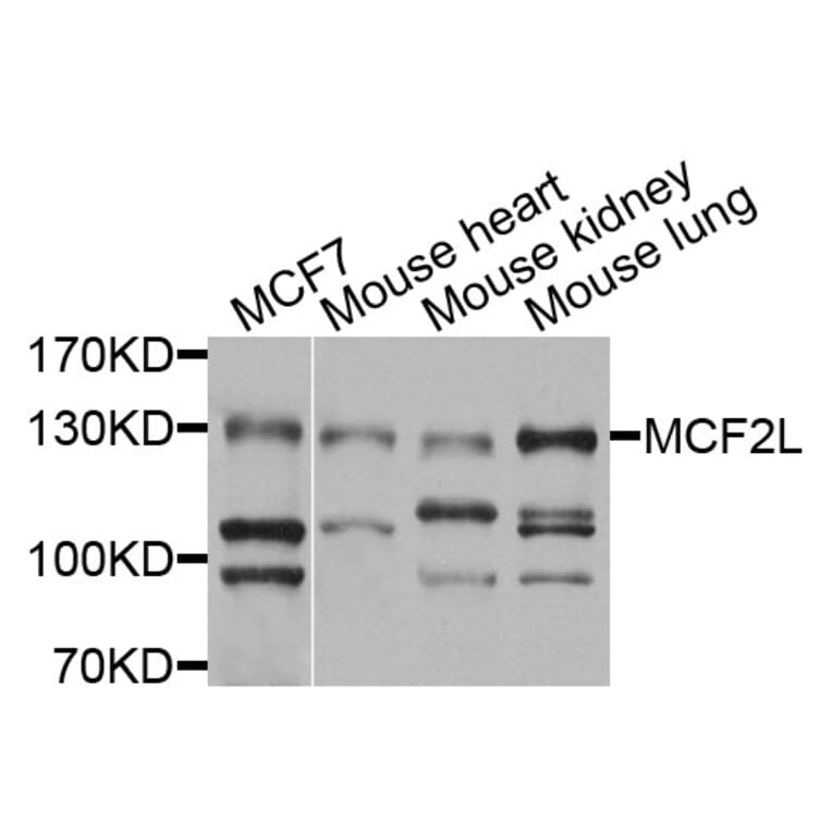 Western Blot - Anti-MCF2L Antibody (A9966) - Antibodies.com