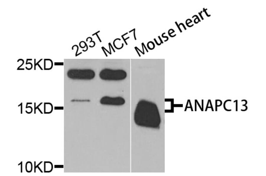 Western Blot - Anti-ANAPC13 Antibody (A9967) - Antibodies.com