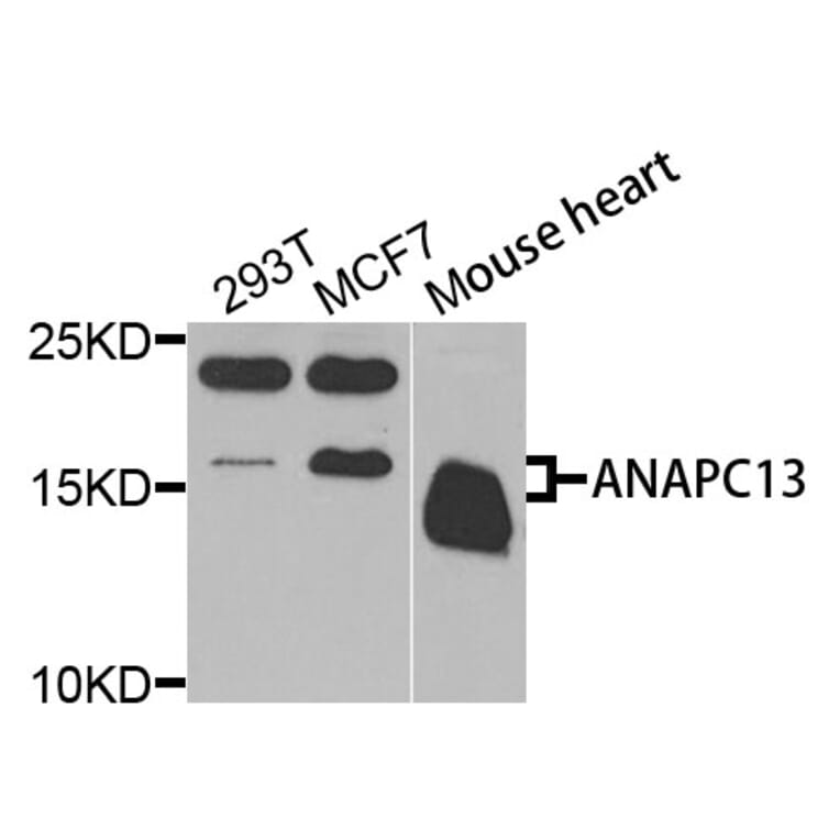Western Blot - Anti-ANAPC13 Antibody (A9967) - Antibodies.com