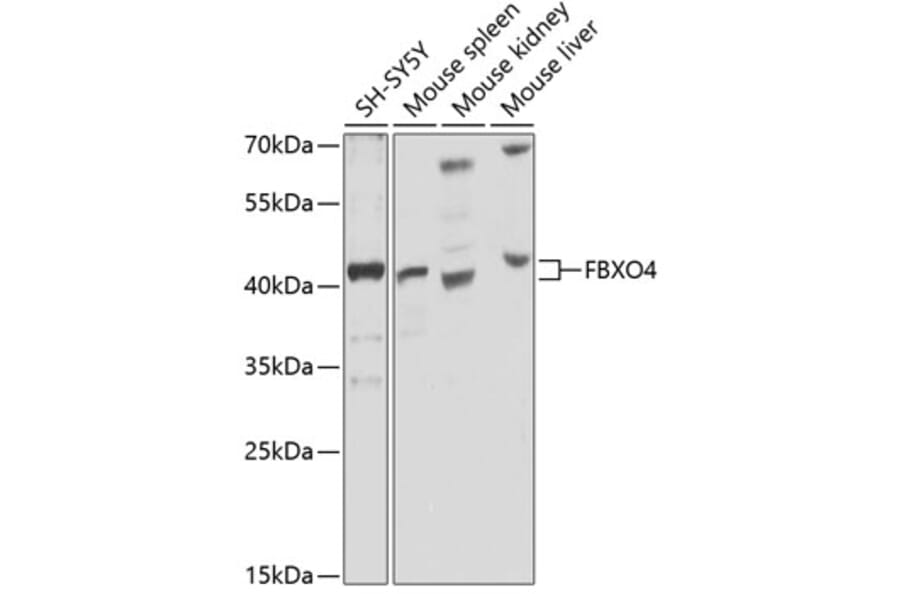 Western Blot - Anti-FBXO4/FBX4 Antibody (A12437) - Antibodies.com