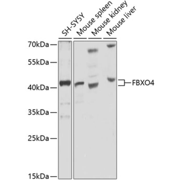 Western Blot - Anti-FBXO4/FBX4 Antibody (A12437) - Antibodies.com