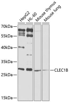 Western blot analysis of extracts of various cell lines, using Anti-CLEC1B Antibody (A9971) at 1:1,000 dilution.
Secondary antibody: Goat Anti-Rabbit IgG (H+L) (HRP) (AS014) at 1:10,000 dilution.
Lysates / proteins: 25µg per lane.
Blocking buffer: 3% non-fat dry milk in TBST.
Detection: ECL Basic Kit (RM00020).
Exposure time: 90s.