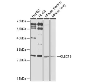 Western Blot - Anti-CLEC-2 Antibody (A12438) - Antibodies.com