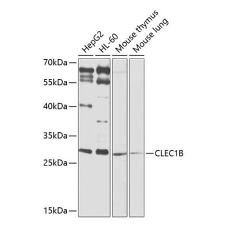 Western Blot - Anti-CLEC-2 Antibody (A12438) - Antibodies.com