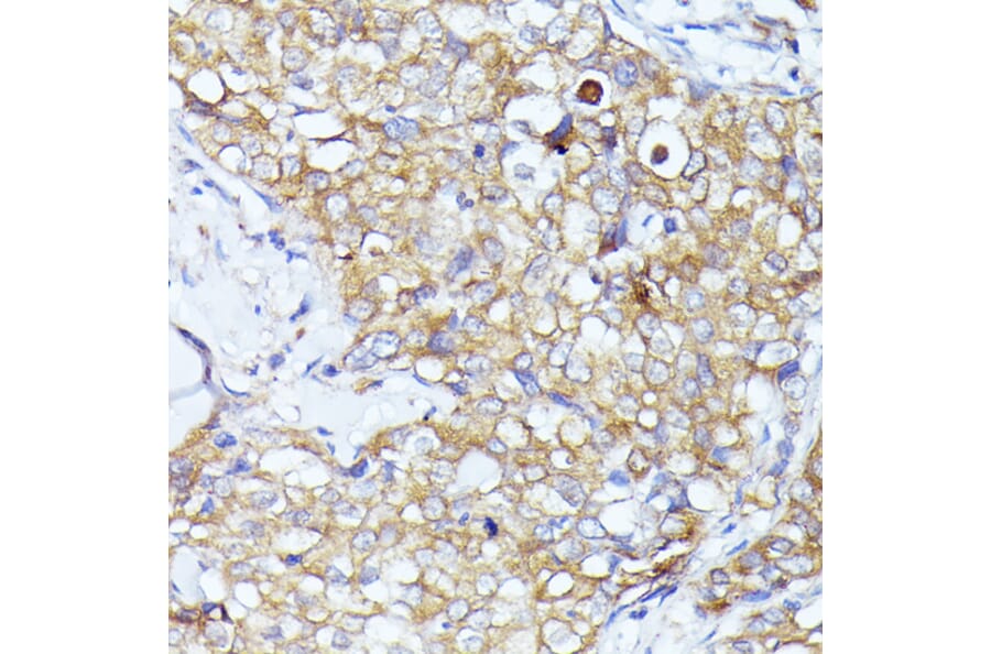 Immunohistochemistry - Anti-eIF3l Antibody (A12439) - Antibodies.com