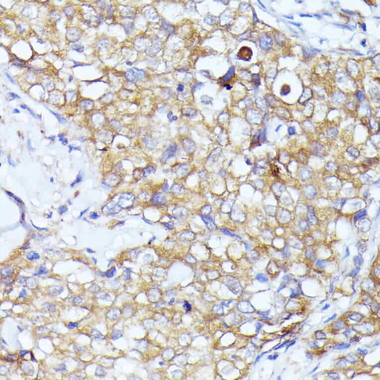 Immunohistochemistry - Anti-eIF3l Antibody (A12439) - Antibodies.com