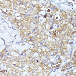 Immunohistochemistry - Anti-eIF3l Antibody (A12439) - Antibodies.com