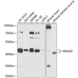 Western Blot - Anti-Rag D Antibody (A12440) - Antibodies.com