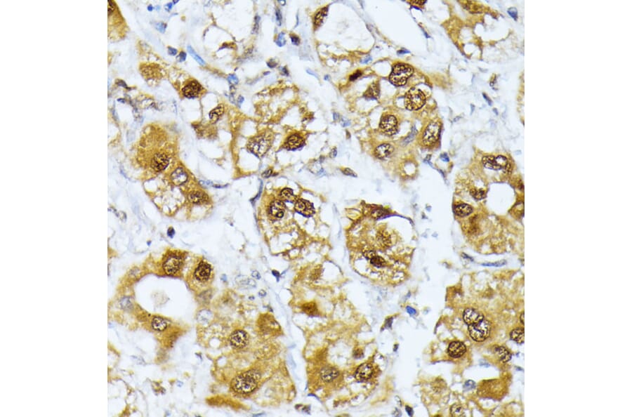Immunohistochemistry - Anti-Rag D Antibody (A12440) - Antibodies.com