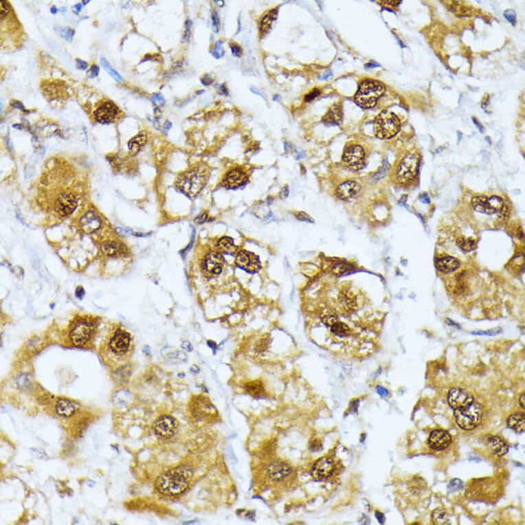 Immunohistochemistry - Anti-Rag D Antibody (A12440) - Antibodies.com