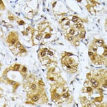 Immunohistochemistry - Anti-Rag D Antibody (A12440) - Antibodies.com
