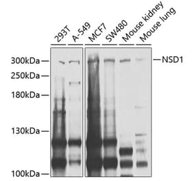 Western Blot - Anti-NSD1 Antibody (A9981) - Antibodies.com