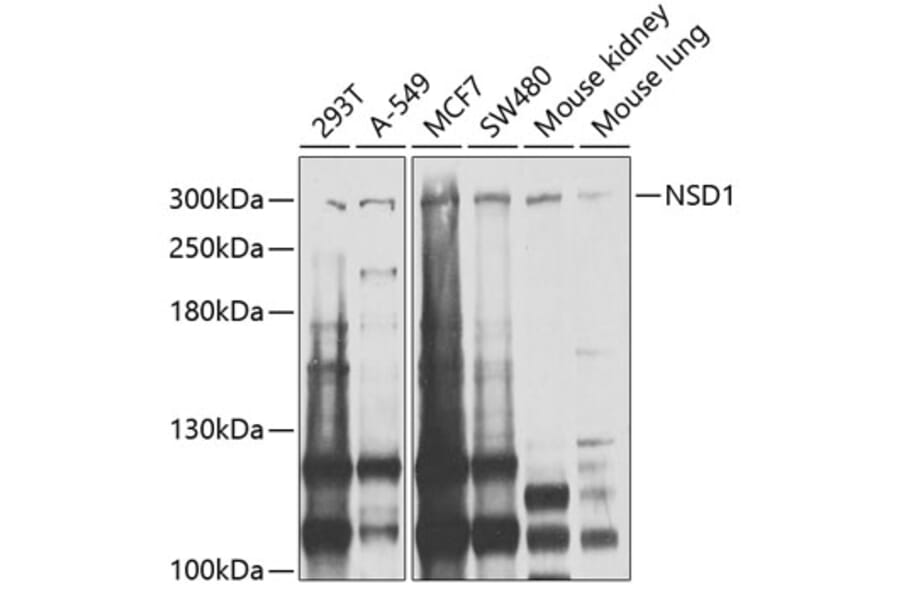 Western Blot - Anti-NSD1 Antibody (A124414) - Antibodies.com