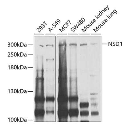 Western Blot - Anti-NSD1 Antibody (A124414) - Antibodies.com