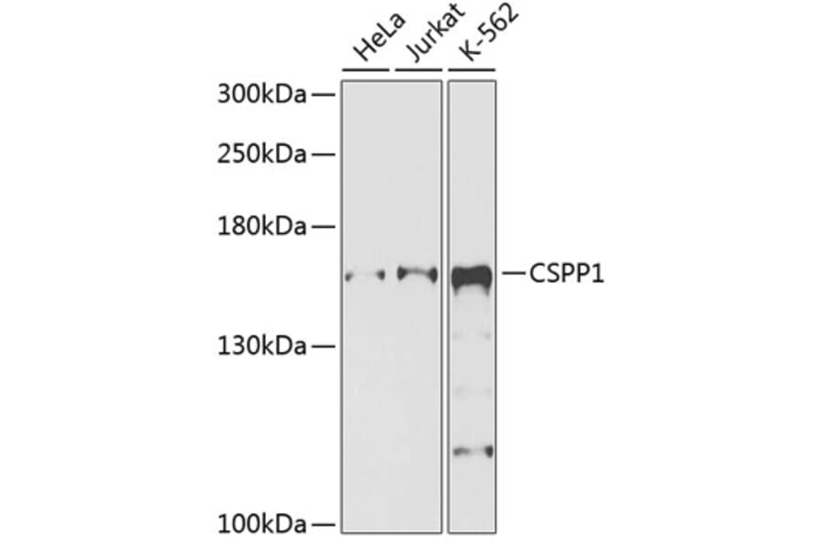 Western Blot - Anti-CSPP1 Antibody (A12442) - Antibodies.com