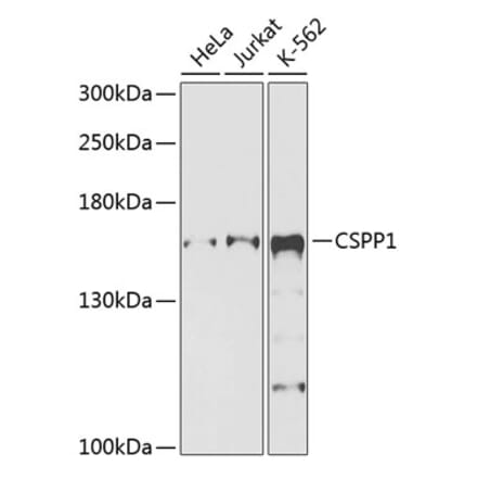 Western Blot - Anti-CSPP1 Antibody (A12442) - Antibodies.com