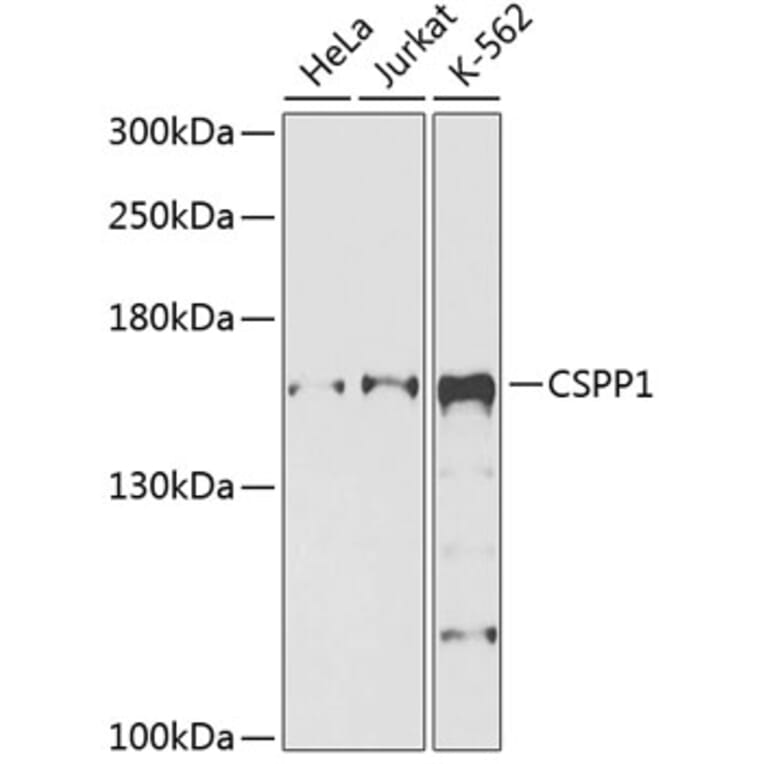 Western Blot - Anti-CSPP1 Antibody (A12442) - Antibodies.com