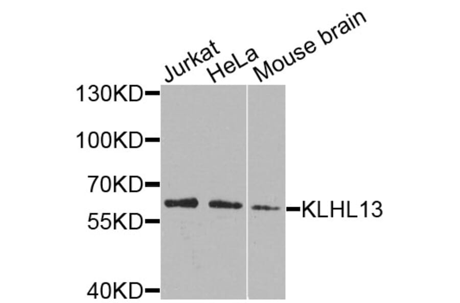 Western Blot - Anti-KLHL13 Antibody (A9989) - Antibodies.com