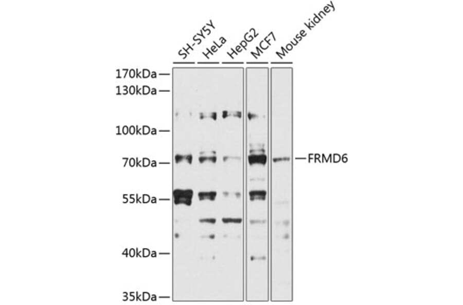 Western Blot - Anti-FRMD6/Willin Antibody (A12445) - Antibodies.com