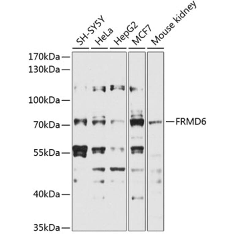 Western Blot - Anti-FRMD6 / Willin Antibody (A12445) - Antibodies.com