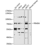 Western Blot - Anti-FRMD6 / Willin Antibody (A12445) - Antibodies.com