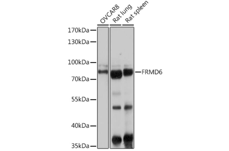 Western Blot - Anti-FRMD6/Willin Antibody (A12445) - Antibodies.com