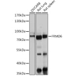 Western Blot - Anti-FRMD6 / Willin Antibody (A12445) - Antibodies.com