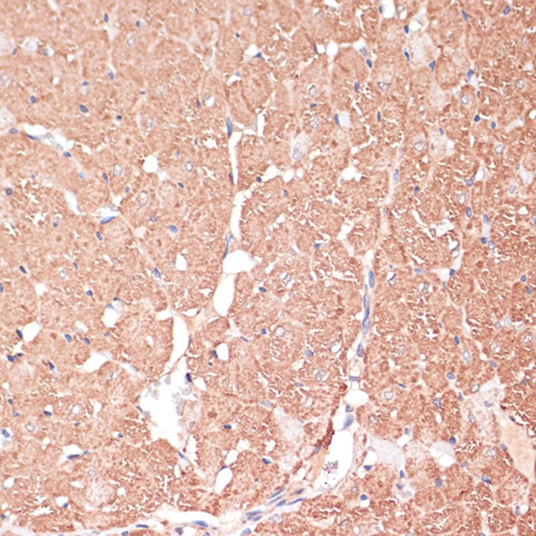 Immunohistochemistry - Anti-FRMD6 / Willin Antibody (A12445) - Antibodies.com