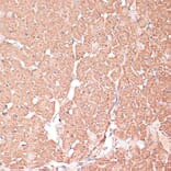 Immunohistochemistry - Anti-FRMD6 / Willin Antibody (A12445) - Antibodies.com