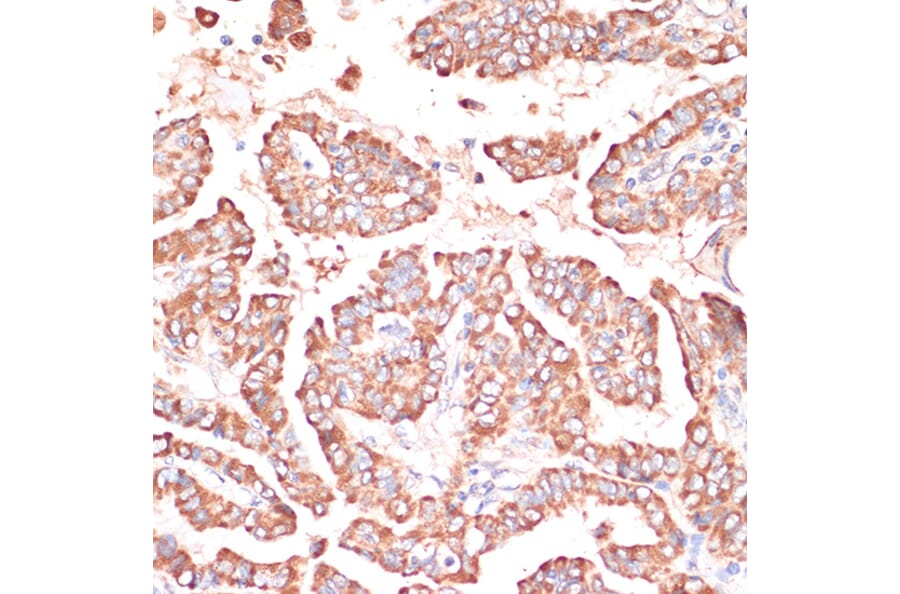 Immunohistochemistry - Anti-FRMD6/Willin Antibody (A12445) - Antibodies.com
