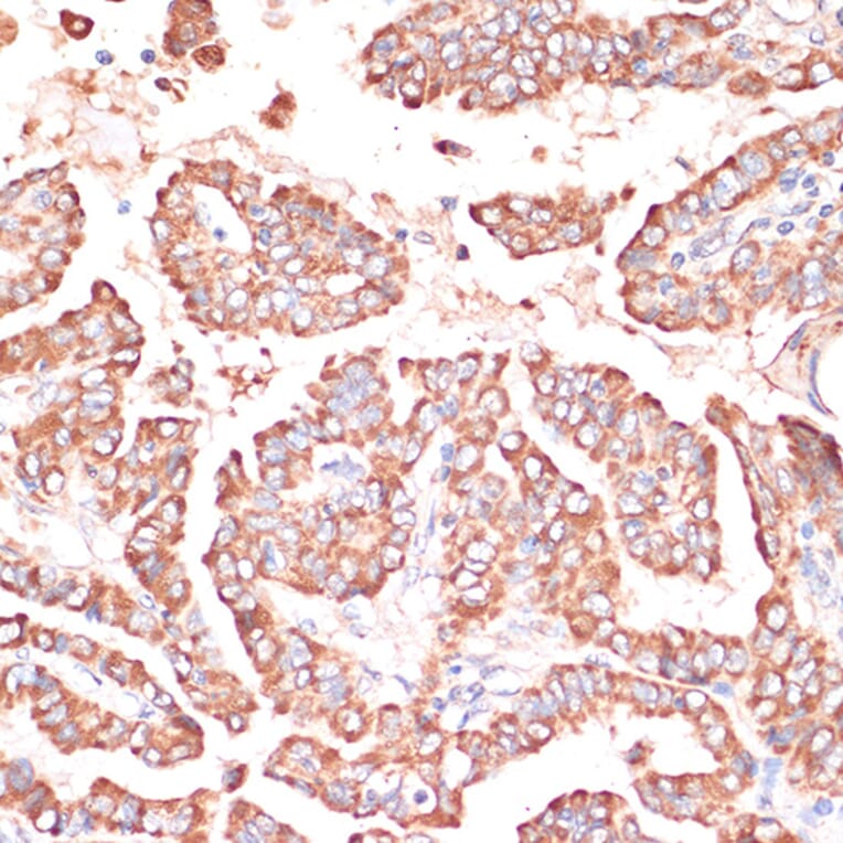 Immunohistochemistry - Anti-FRMD6 / Willin Antibody (A12445) - Antibodies.com