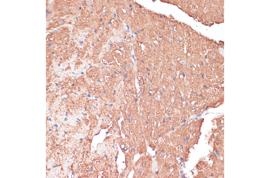 Immunohistochemistry - Anti-FRMD6/Willin Antibody (A12445) - Antibodies.com