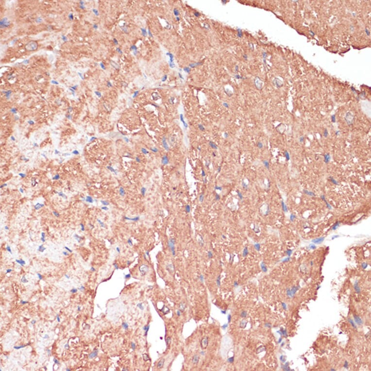 Immunohistochemistry - Anti-FRMD6 / Willin Antibody (A12445) - Antibodies.com