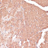 Immunohistochemistry - Anti-FRMD6 / Willin Antibody (A12445) - Antibodies.com