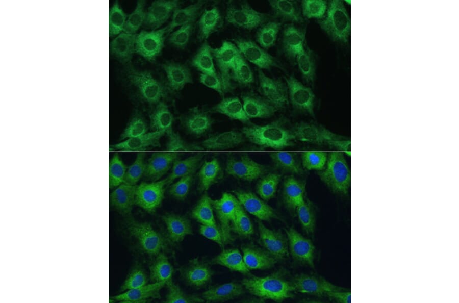 Immunofluorescence - Anti-FRMD6/Willin Antibody (A12445) - Antibodies.com