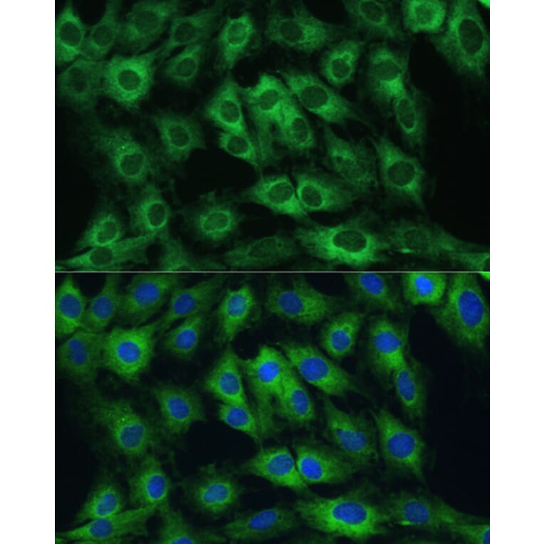 Immunofluorescence - Anti-FRMD6 / Willin Antibody (A12445) - Antibodies.com