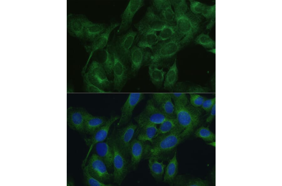 Immunofluorescence - Anti-FRMD6/Willin Antibody (A12445) - Antibodies.com