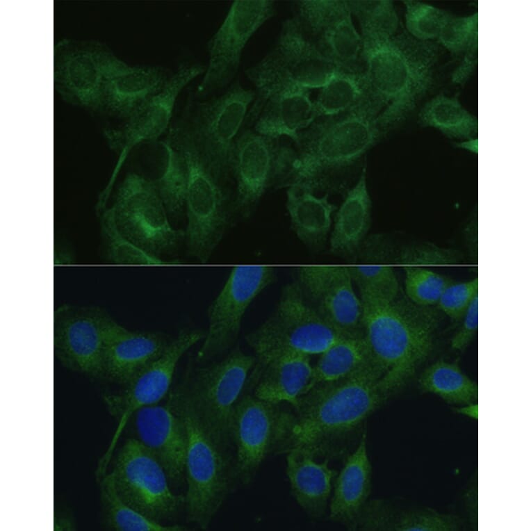 Immunofluorescence - Anti-FRMD6 / Willin Antibody (A12445) - Antibodies.com