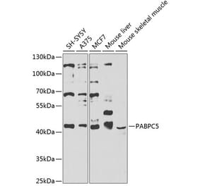 Western Blot - Anti-PABPC5 Antibody (A12446) - Antibodies.com