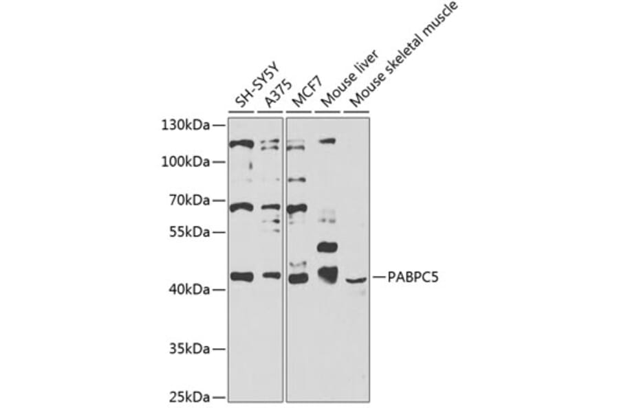 Western Blot - Anti-PABPC5 Antibody (A12446) - Antibodies.com