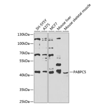 Western Blot - Anti-PABPC5 Antibody (A12446) - Antibodies.com