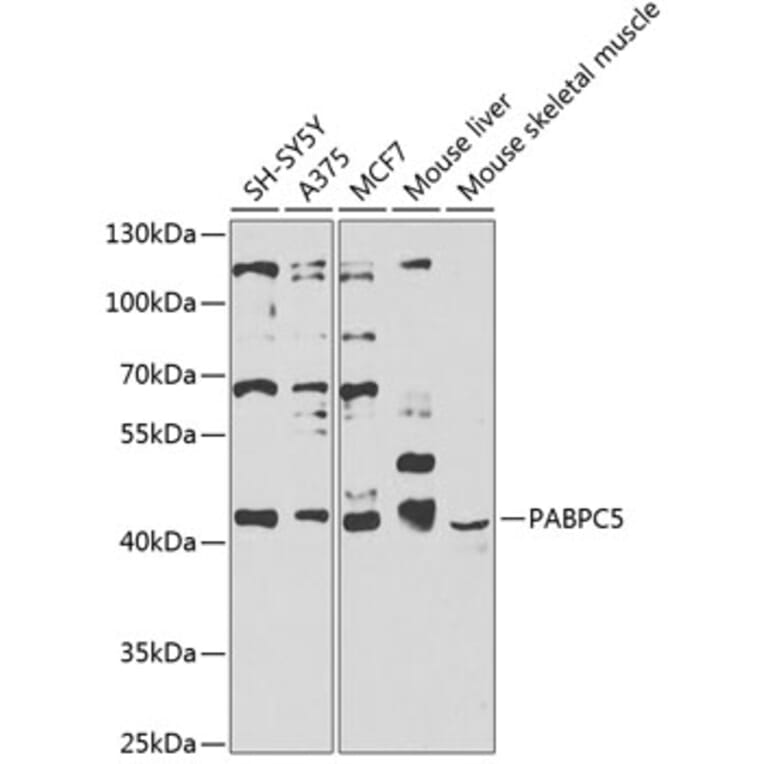 Western Blot - Anti-PABPC5 Antibody (A12446) - Antibodies.com