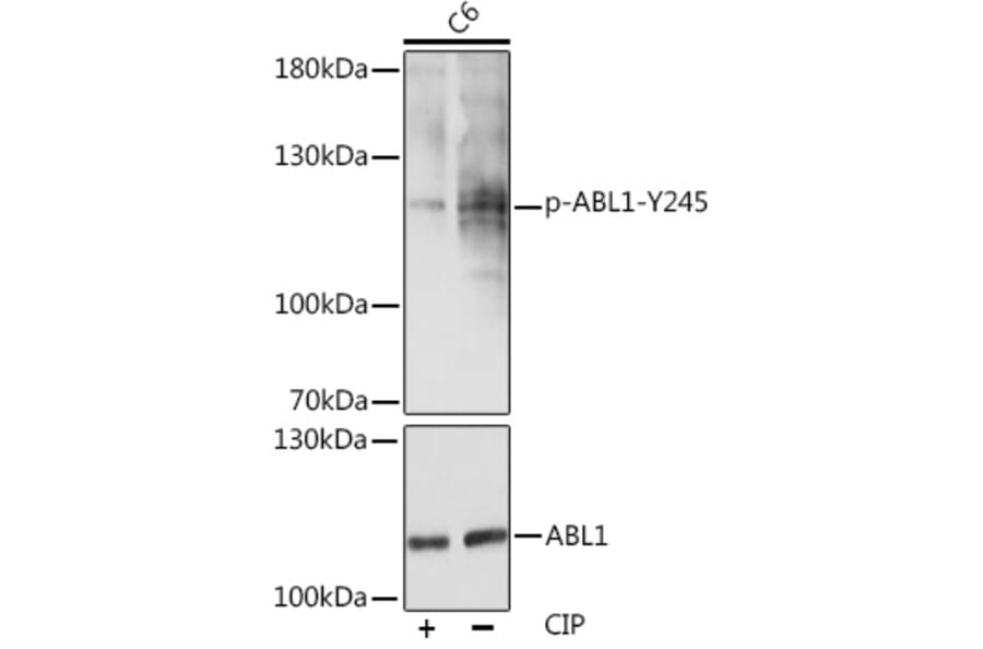 Western Blot - Anti-ABL1 (phospho Tyr245) Antibody (A12447) - Antibodies.com