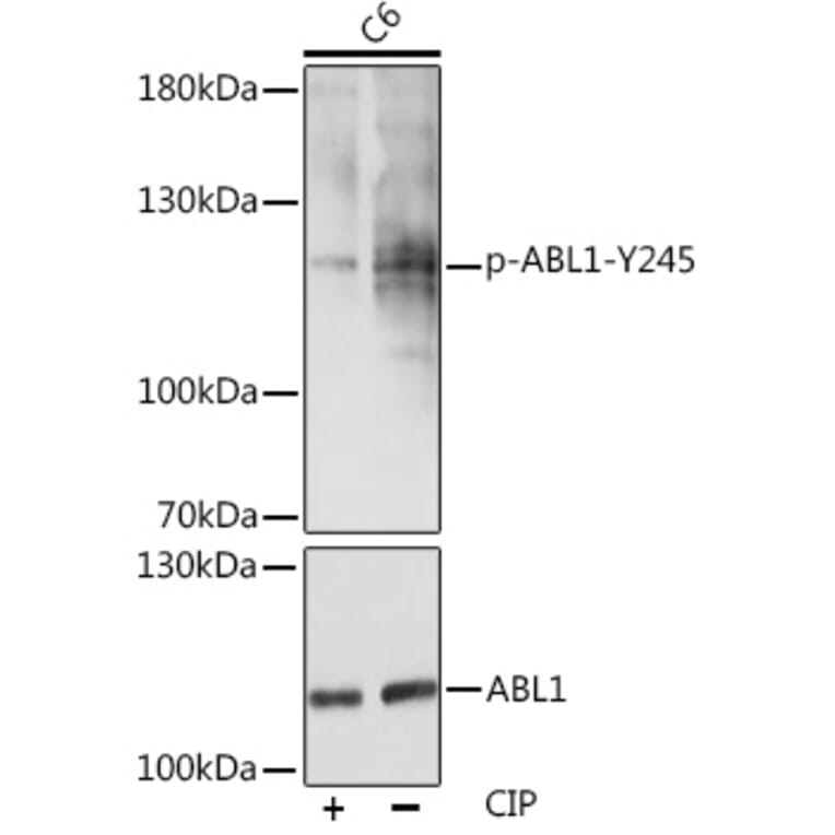 Western Blot - Anti-ABL1 (phospho Tyr245) Antibody (A12447) - Antibodies.com